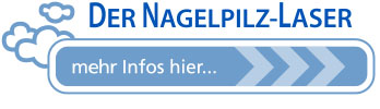 Nagelpilz Laser